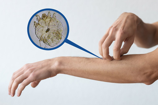 Primer plano de la espalda de un hombre con piel descamada