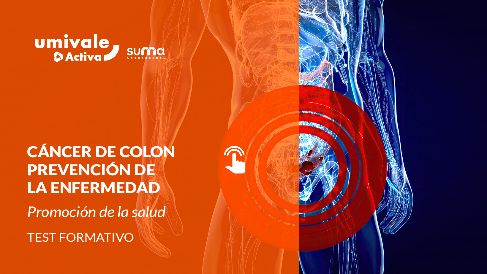 Ilustración abstracta del cáncer de colon